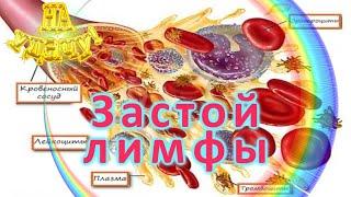 Застой лимфы. Почему появляются отеки под глазами, на руках и ногах и как от них избавиться