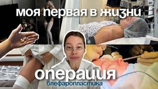 СДЕЛАЛА БЛЕФАРОПАСТИКУ В 25 ЛЕТ | ДО ПОСЛЕ БЕЗ ЦЕНЗУРЫ