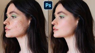 Face Retouching | Skin Retouching | Easy Photoshop Tutorial