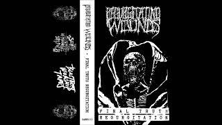 Regurgitating Wounds - Decomposed Dismemberment / Purpura Decomposis (2024 - Goregrind)