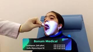 LOR (Qulaq-Burun-Boğaz) -Bonum Medical