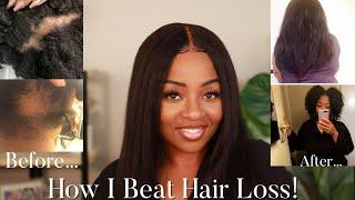 From BALDING To WAIST LENGTH: Fighting And BEATING Alopecia! | Plus Hair Goal Tips!!!