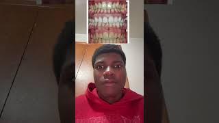 #funny #freestylerap #rap #ishowspeed #rapper #duet #amp #freestylerapper #speed #drill