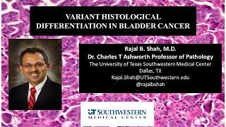 A Dummies Guide to Variant Histological Differentiation in Bladder Cancer