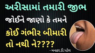 અરીસામાં તમારી જીભ જોઈને જાણો કે તમને કોઈ ગંભીર બીમારી તો નથી ને????