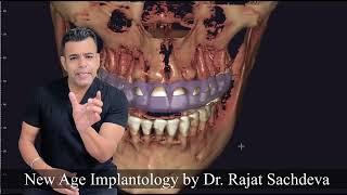 STOP Wasting Money on Dental Implants Until You Watch This!