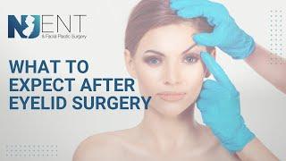 What to Expect After Eyelid Surgery | We Nose Noses