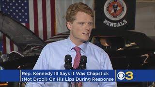 No, That Wasn't Drool On His Lips, Rep. Joe Kennedy Says