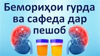 Гурда. Беморихои гурда ва сафеда дар пешоб. Уролог Андролог Алишер Бораҷабов. #Пешоб