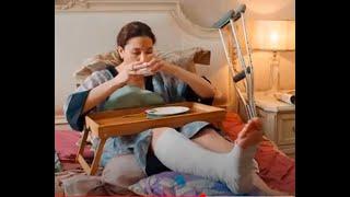 Broken leg cast , crutches, exposed toes