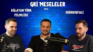 AĞLATAN TÜRK FİLMLERİ, HİDROSEFALİ, Berkan Aytekin, Gri Meseleler Podcast #40