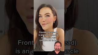 Botox for Hooded Eyes - Surgeon Reacts