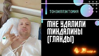 Мне удалили гланды(миндалины). Тонзиллэктомия. Операция. Жизнь без небных миндалин.)