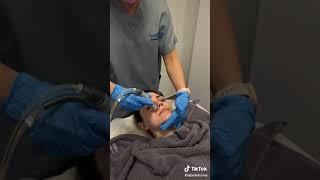 The magic of Hydrafacial - Glasgow