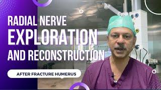 Surgery @ GK Hand Surgery: Ep 2 - Radial nerve exploration and reconstruction after fracture humerus