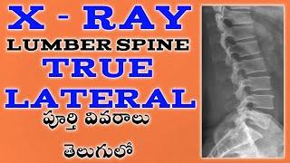 x ray lumber spine lateral position in telugu