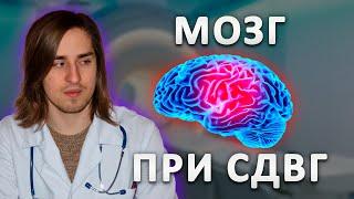 Нейробиолог про мозг при СДВГ.