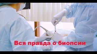 Биопсия (инвазивная пренатальная диагностика)