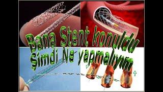 Stent uygulandı nelere dikkat etmem lazım