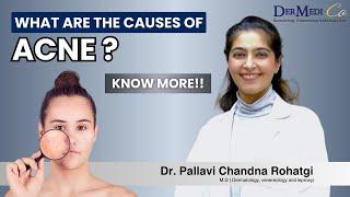 Do you know this may cause to acne | Dr. Pallavi Rohatagi | Dermedico