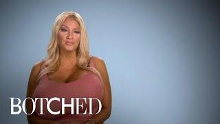 Allegra Explains Her Growing Giant Breasts | Botched | E!