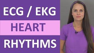 EKG Rhythms | ECG Heart Rhythms Explained - Comprehensive NCLEX Review