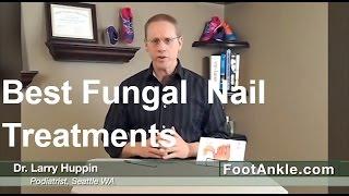 What are the Best Treatments for Fungal Toenails - Seattle Podiatrist Larry Huppin