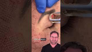 This New Eyelid Treatment Will Make You Look Years Younger!