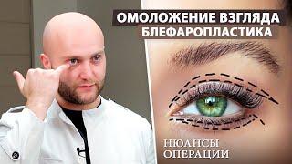 Для чего нужна блефаропластика? (пластика верхних и нижних век)