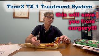TeneX TX-1 Treatment System - Game-Changing Arthritis Tech