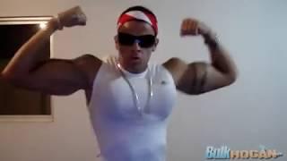 Synthol Abuse definitely not a bodybuilder RODRIGO FERRAZ