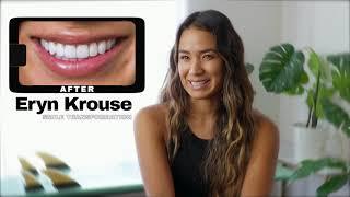 Smile Makeover Patient Story with Youtuber Eryn Krouse