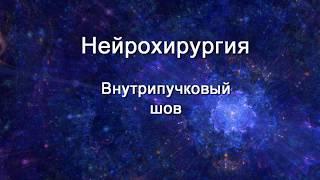 ЯГМУ Нейрохирургия - Внтрипучковый шов