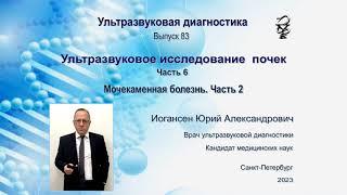 Ультразвуковая диагностика (УЗИ). Доктор Иогансен. Выпуск 83. Мочекаменная болезнь. Часть 2.