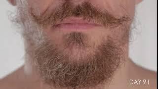 Facial Hair growing for 100 Days in Time-Lapse