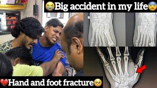 Big accident in my life￼|Hand and foot fracture| Aj Squad | Ajees