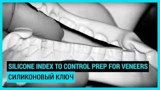 Silicone index to control prep for veneers. Силиконовый ключ