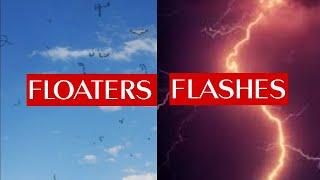 FLOATERS & FLASHES in EYE (photopsias)