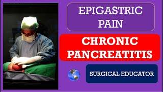 CHRONIC PANCREATITIS- How To DIAGNOSE & TREAT  / EPIGASTRIC PAIN