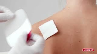 Hypafix Transparent - Abrasions