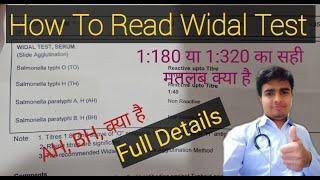 Widal Test । How To Read Report (Enteric Fever Report) / Be Your Best Doctor