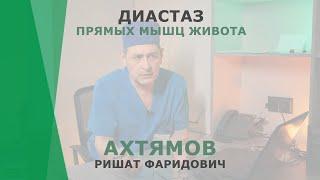 Диастаз прямых мышц живота | Ахтямов Ришат Фаридович | Хирург КОРЛ Казань