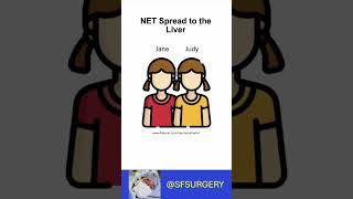 Low Volume Neuroendocrine Tumor Liver Metastases (NELMs): Avoid Overtreatment of Low Volume NELMs