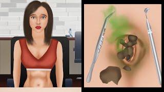 ASMR Animation| Huge Navel Stone Removal | Satisfying ASMR