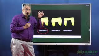 Inlays and Onlays - What? Why? How?  Making Conservative Dentistry easier.. by Dr.Arvind Shenoy Sir.