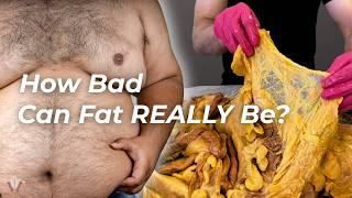 How Too Much Fat Affects Nearly Every Part of Your Body