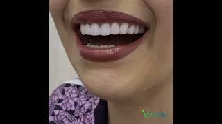 Vsmile Dental Case