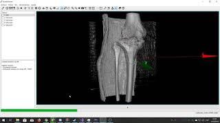 BonesViewer - Split Volume using Neighbour Algorithm (VTK+Qt)