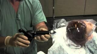 External Ventricular Drain Placement by Dr. Michael Horowitz M.D.
