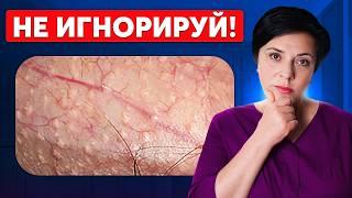 Почему появляются белые пятна под кожей? Гранулы Фордайса